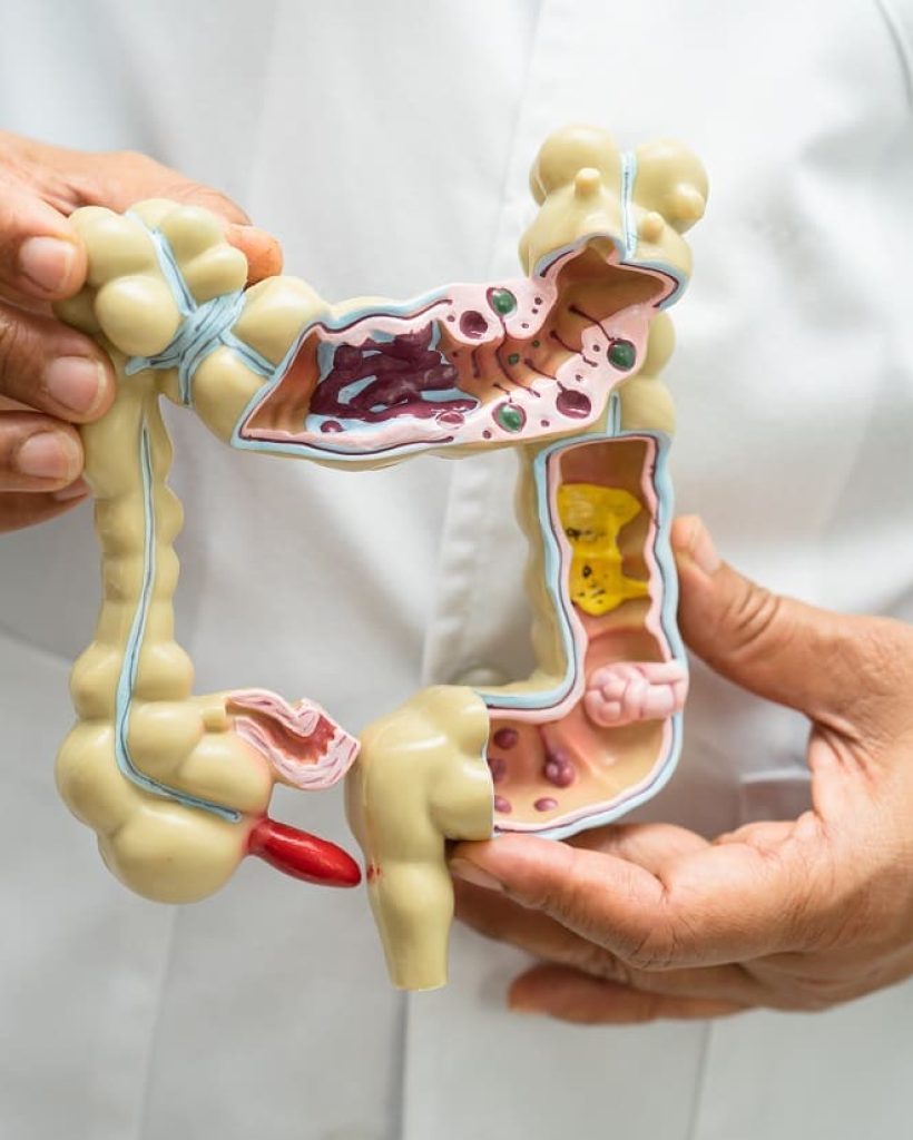 intestine-appendix-and-digestive-system-doctor-h-2023-11-27-05-18-09-utc